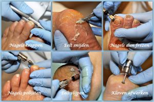 Complete behandeling Pedicuresalon Voetje voor Voetje