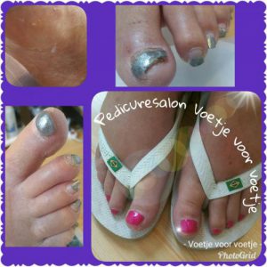 Nagelreparatie Pedicuresalon Voetje voor Voetje